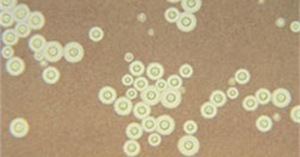 Nhiễm nấm Cryptococcus - Hình ảnh minh họa